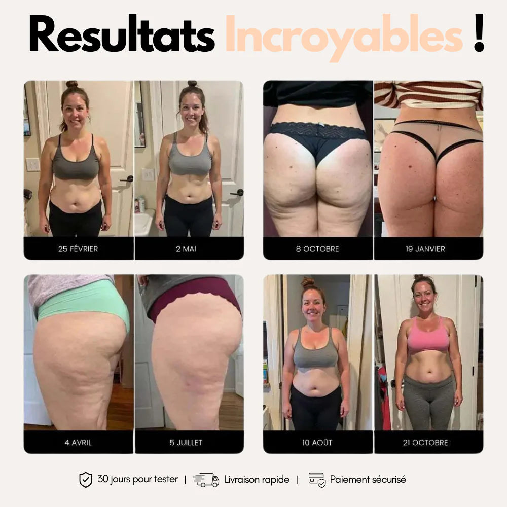 Legging Sculptant Anti-Cellulite NOVA™