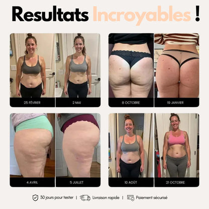 Legging Sculptant Anti-Cellulite NOVA™